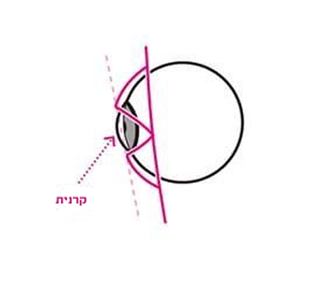 מבנה העין בפרופיל.jpg